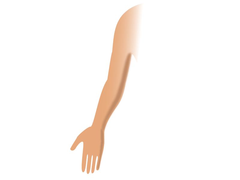 Arm