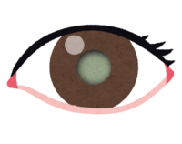 Cataract eyes