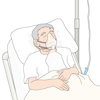 人工呼吸器をつけた高齢男性