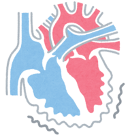 Ventricular fibrillation