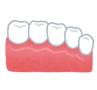 Ceramic teeth (tooth treatment)