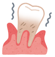 Gingiva of periodontal disease