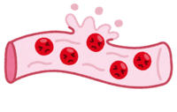 Bleeding blood vessel