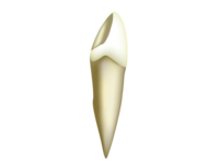 犬歯
