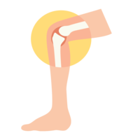 Image of knee joint