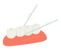 牙线