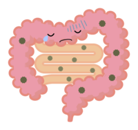 Unhealthy large intestine